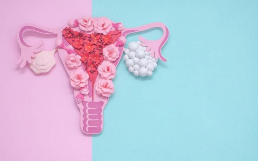 Αντιμετώπιση του συνδρόμου πολυκυστικών ωοθηκών μέσω Προηγμένης Ομοιοπαθητικής θεραπείας