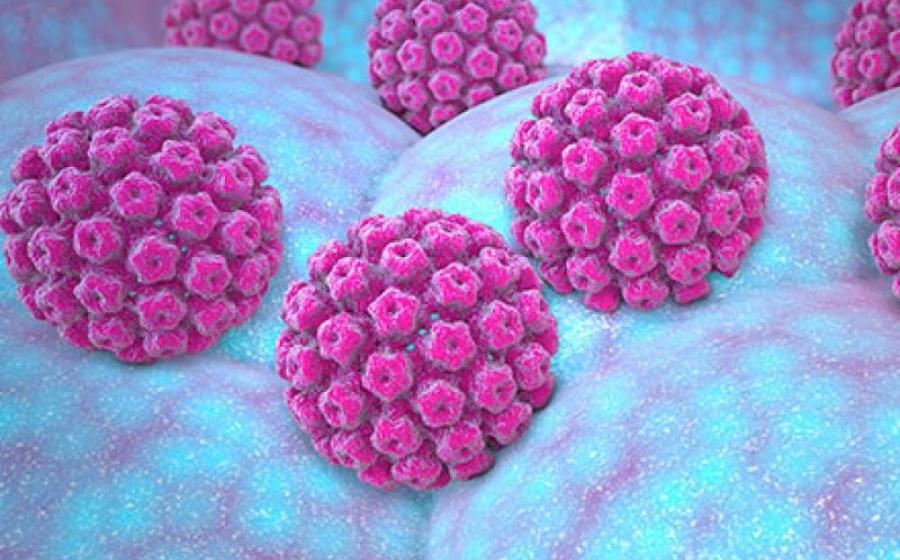 Η συμβολή της Προηγμένης Ομοιοπαθητικής στην αντιμετώπιση των κονδυλωμάτων