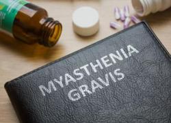Αντιμετώπιση της μυασθένειας Gravis με την βοήθεια της Προηγμένης Ομοιοπαθητικής.