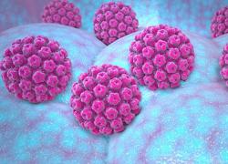 Η συμβολή της Προηγμένης Ομοιοπαθητικής στην αντιμετώπιση των κονδυλωμάτων